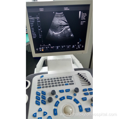 Full digital 4D Laptop color doppler Ultrasound Machine